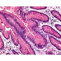 Product Image of Formaldehyd Lösung min. 37% säurefrei stab. mit etwa 10% Methanol und Calciumcarbonat, 1 Liter, für die Histologie