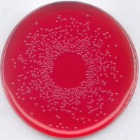 Product Image of MTO-CARBOTRAP C, 20/40 MESH, 500GM