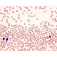 Product Image of Hemacolor Fast dyeing of blood smears dyeing set for microscopy, 3x500 ml, 1 SET