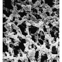 Product Image of Membranfilter, rund, MF-Millipore, MCE, 47 mm, 5,00 µm, 100/Pak