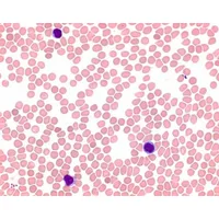 Product Image of May-Grünwalds Eosin-Methylenblau Lösung modifiziert für die Mikroskopie, 2,5 Liter