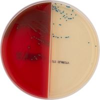 Product Image of Columbia CNA Aesculin Selective Agar / Brilliance™UTI Clarity Bi-plate