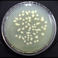 Abklatschplatte Caseinpepton- Sojamehlpepton-Agar mit Enthemmer, 10 Platten, Haltbarkeit in Tagen: 105, Abgabe nur im 2er Pack