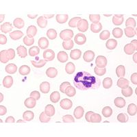 Product Image of Hemacolor® Schnellfärbung von Blutausstrichen Lösung 1 Fixierlösung, 2,5 l, CAS: 67-56-1