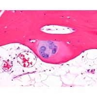 Product Image of OSTEOMOLL fast descaling solution, 1 pc