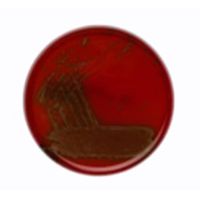 Product Image of Columbia Agar + Sheep Blood, 10 ready-to-use plates, Durability days: 56