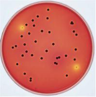 Merck XLT4 agar (Base) for microbiology, 500 g