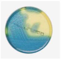 Product Image of Polymyxin Egg Yolk Mannitol Bromothymol Blue Agar (PEMBA), 10 pc/PAK