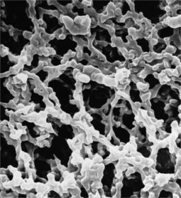 Millipore Membranfilter, rund, MF-Millipore, MCE, 25 mm, 1,20 μm, 100/Pak